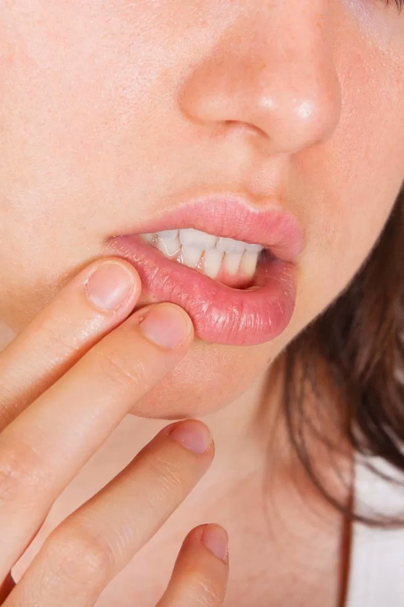 Do you have a citrus allergy?