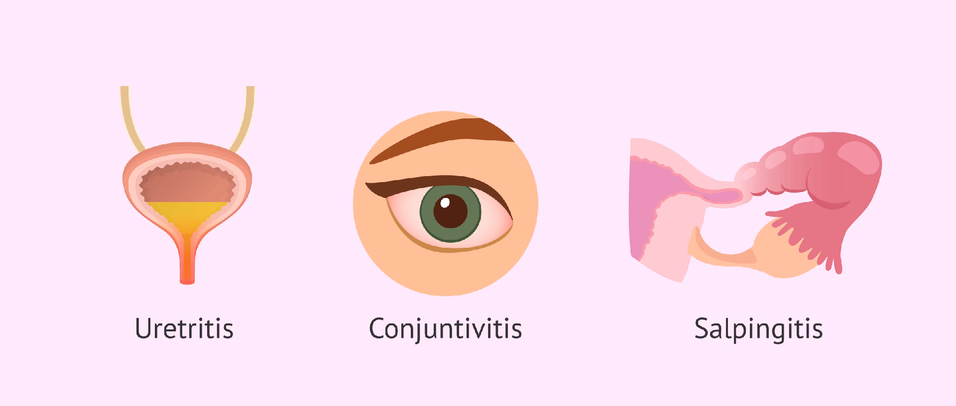 ¿Cómo se contagia la clamidia?