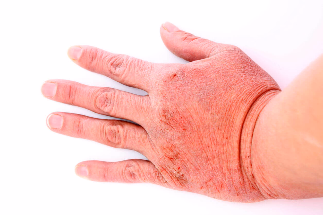 What causes cold hands and feet?
