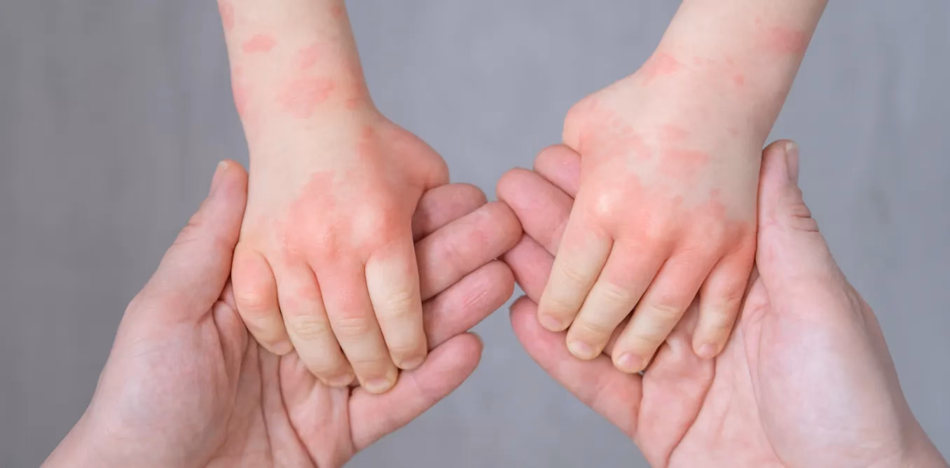 Do you have cold hands?