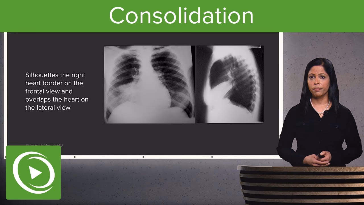 What is a consolidation bronchitis?