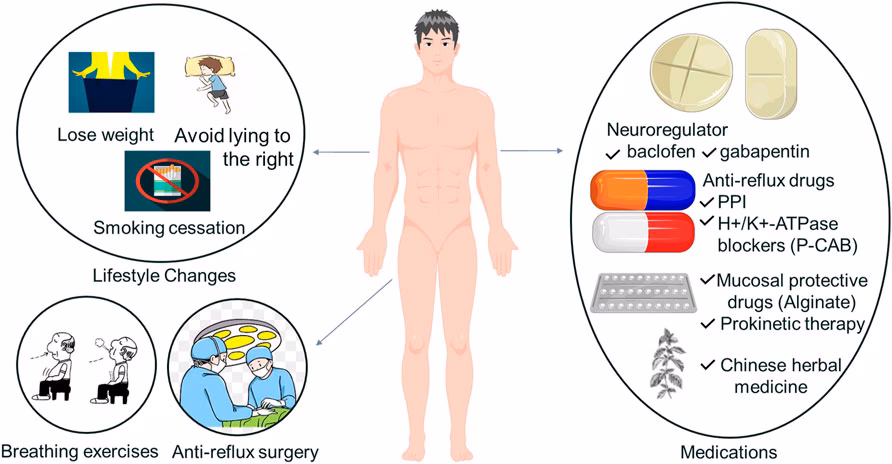 Is a chronic cough a sign of Gerd?