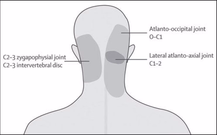 Are headache disorders a disabling condition?