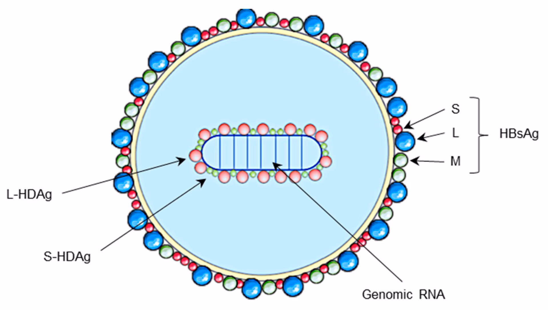 What is chronic viral hepatitis (HDV)?