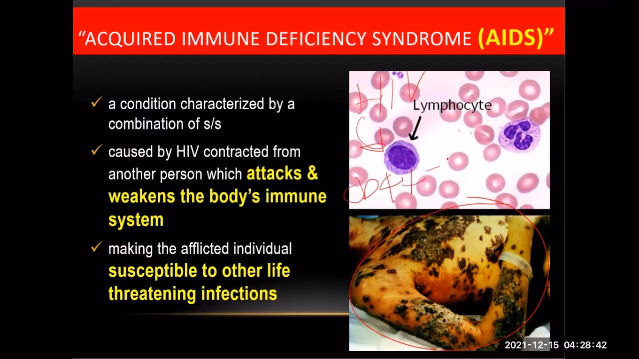 What does AIDS Act do in the Philippines?