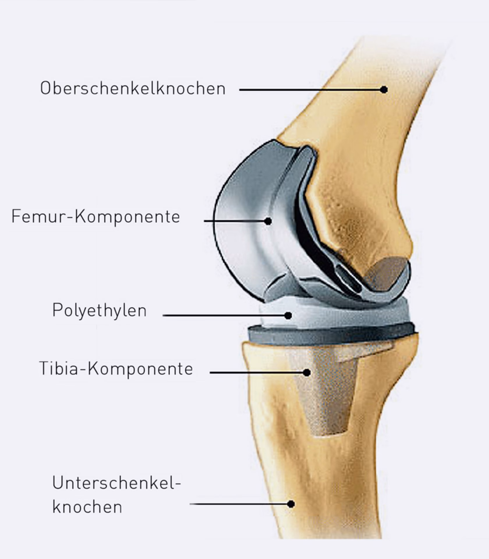 Was geschieht nach einer Knie-Operation?
