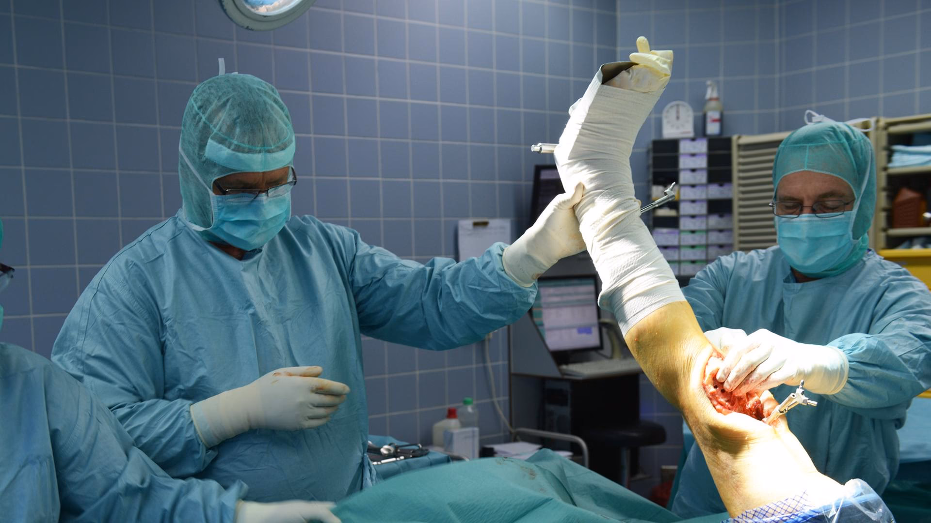 Wie lange bleibt man nach einem künstlichen Kniegelenk im Hospital?