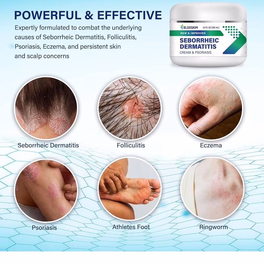 How is dermatitis treated?