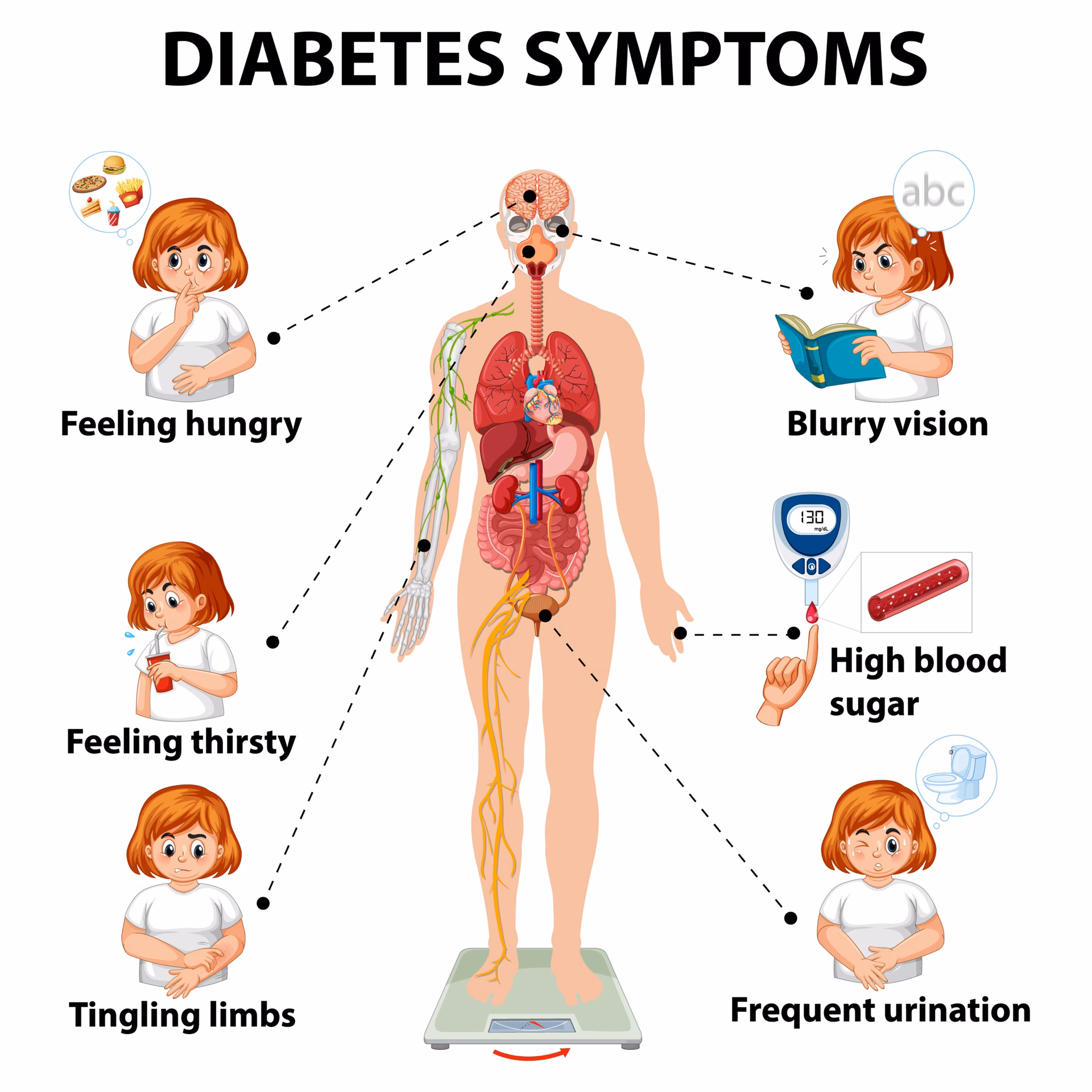 What are the symptoms of type 2 diabetes in women?