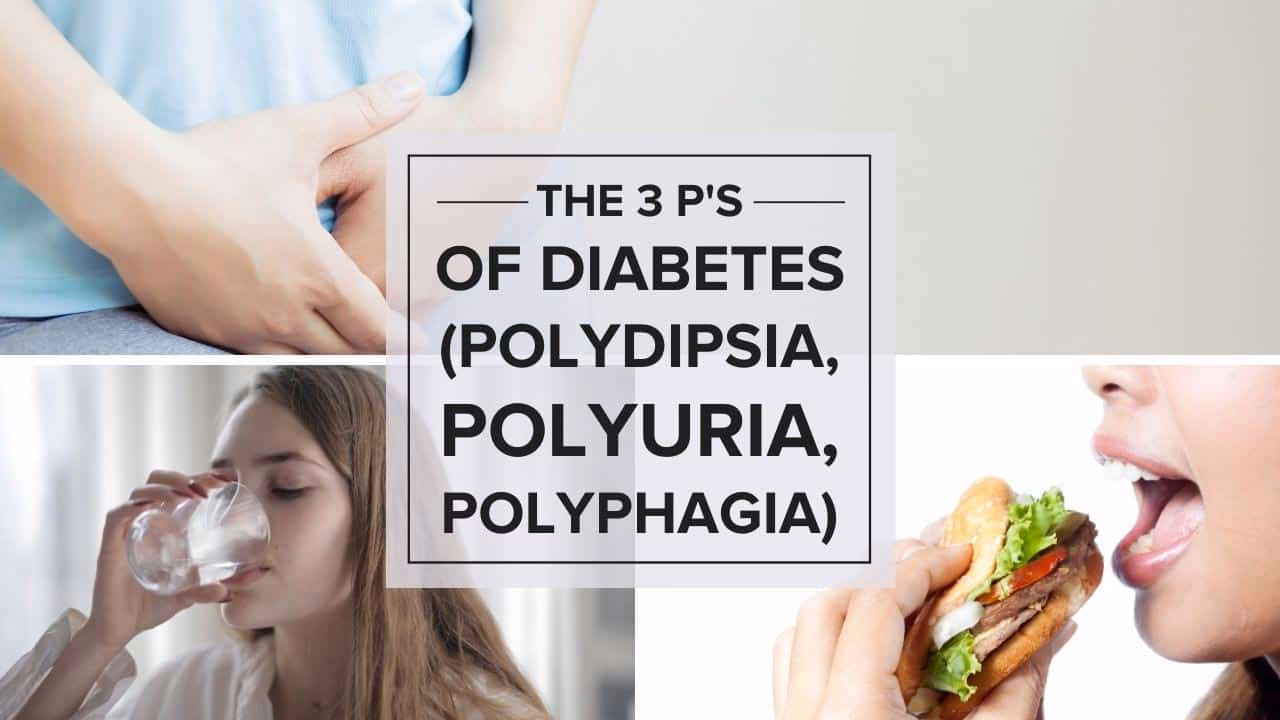 Is polyuria a symptom of diabetes mellitus?