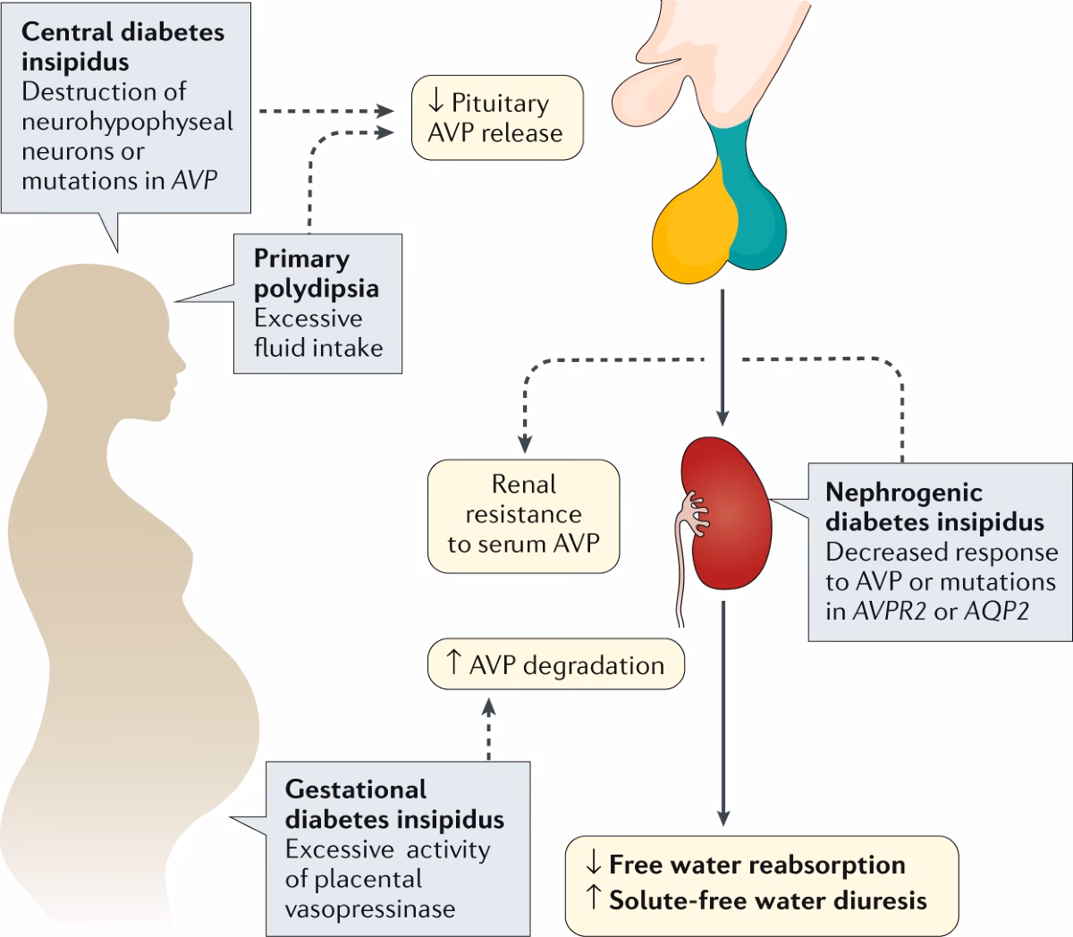 What is diabetes insipidus (DI)?