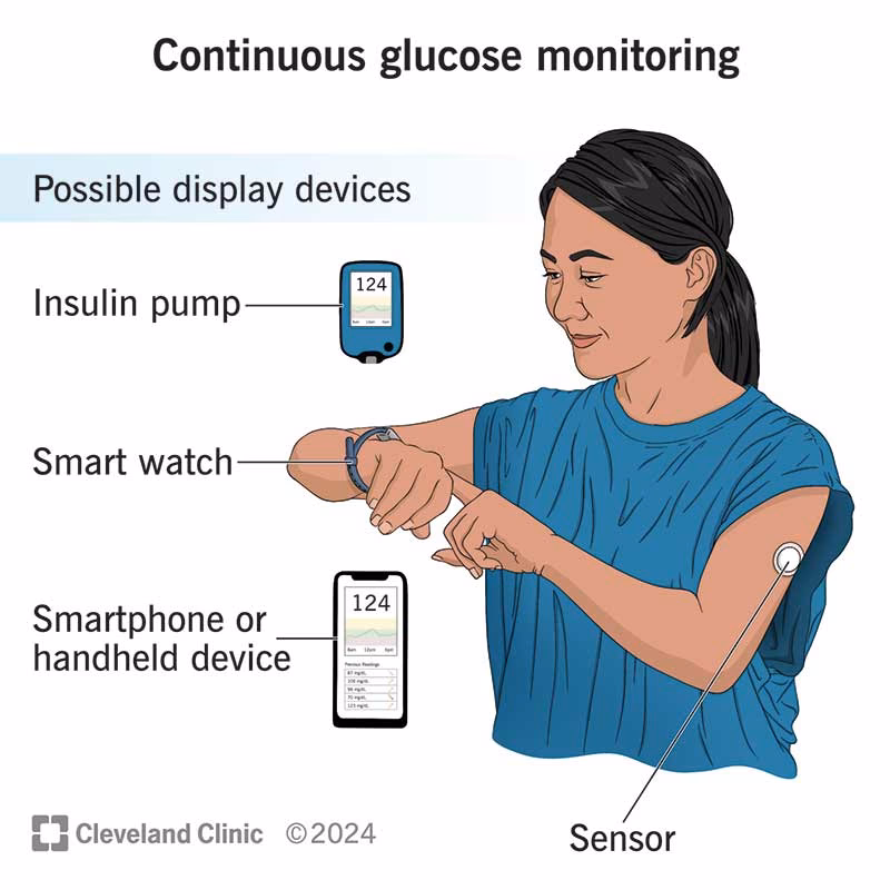 Welche Vorteile bietet die Alarmfunktion für Diabetiker?