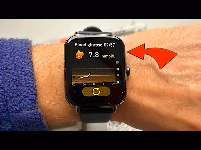 Can a glucose sensor watch help people with diabetes?