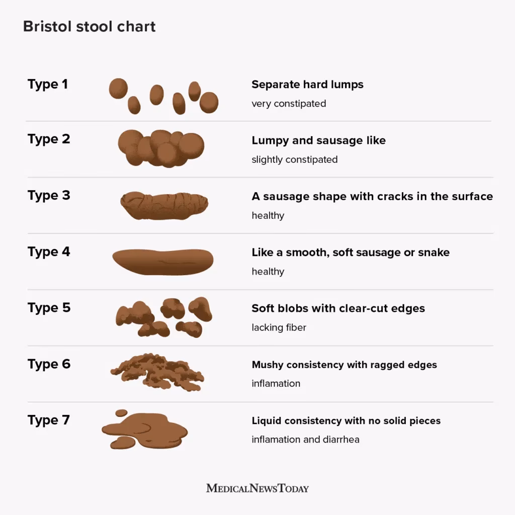 Is a little diarrhea a sign of constipation?