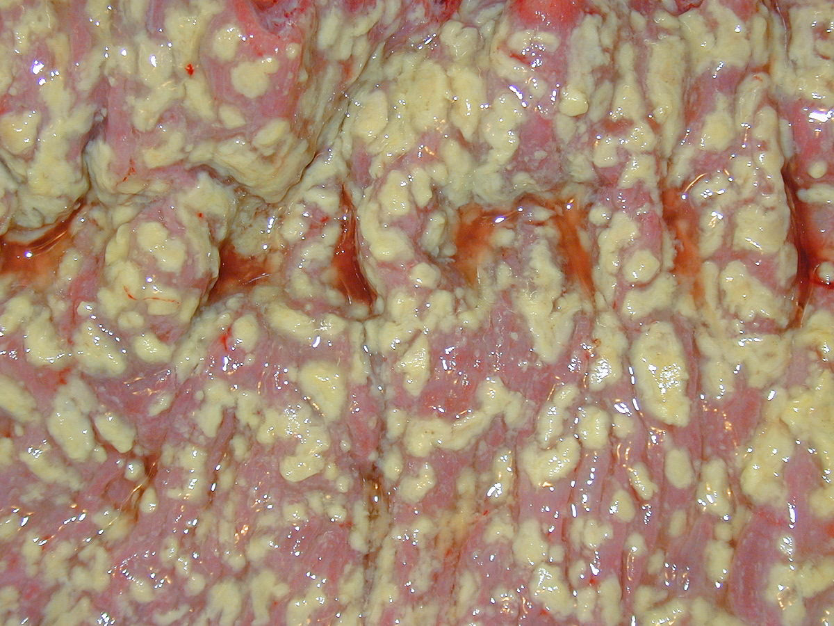 Which ICD 10 code should I use for enterocolitis due to Clostridium difficile?