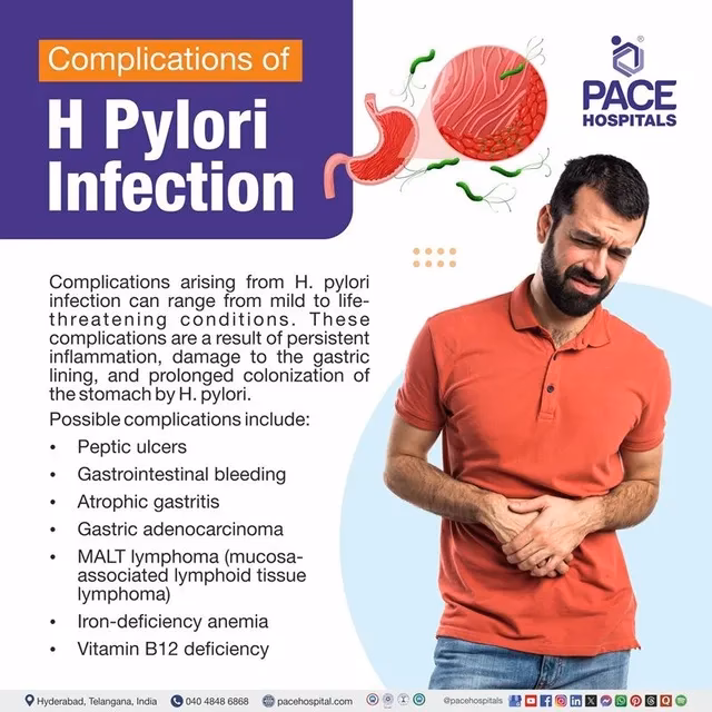 What are the symptoms of H pylori infection?