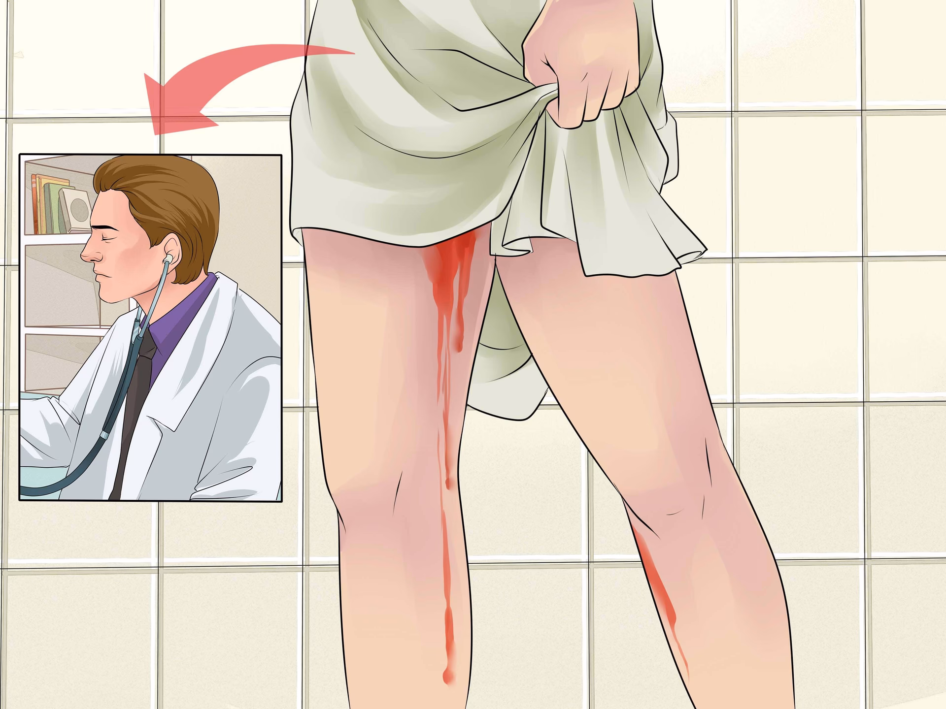 What if my period triggers bloody diarrhea?