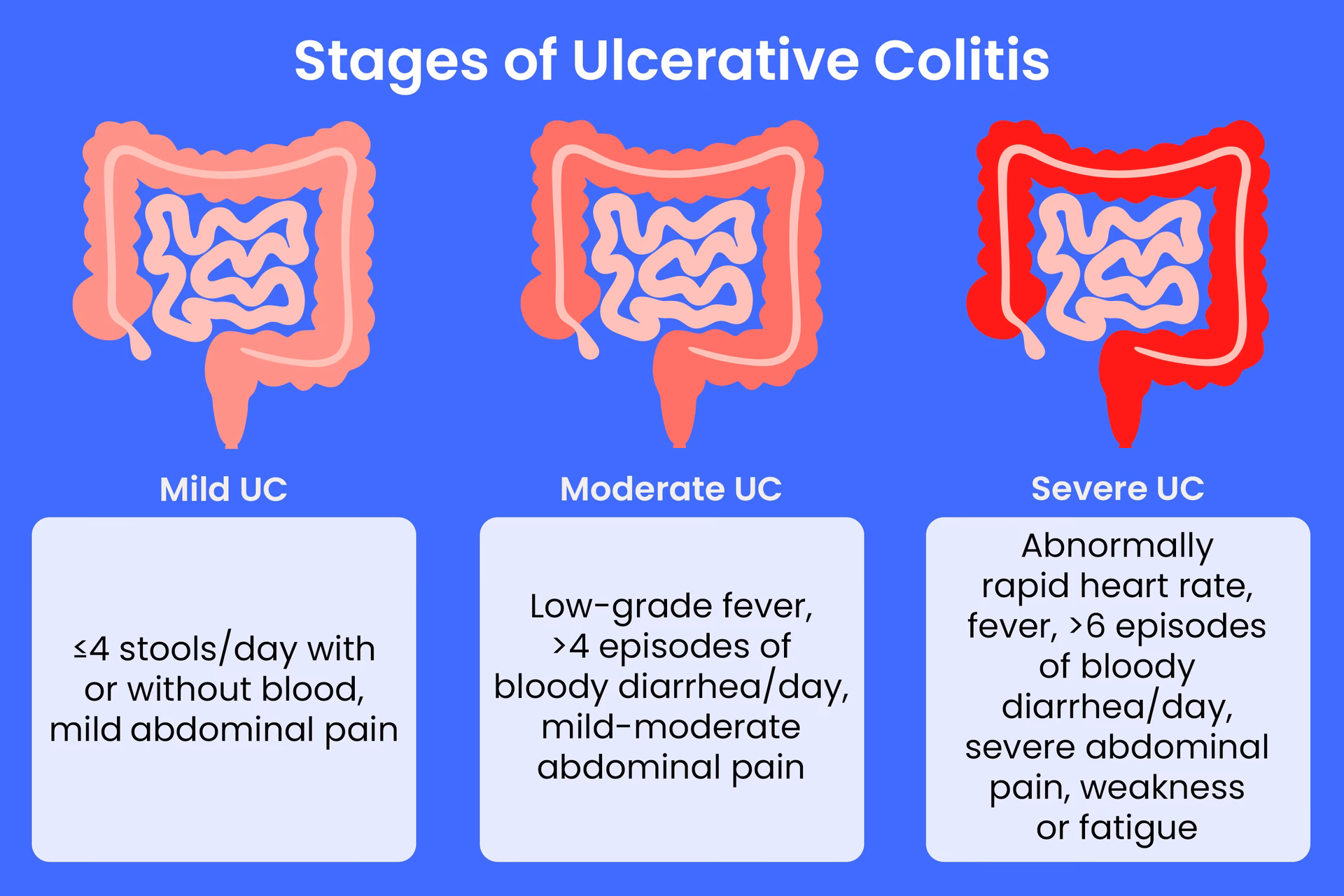 How do you know if you have ulcerative colitis?