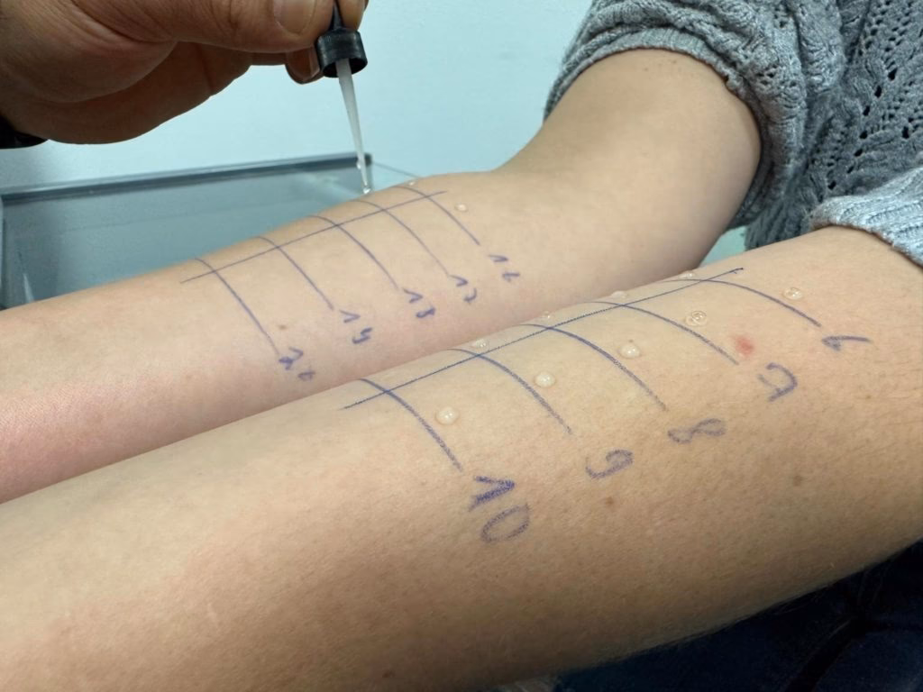 Wie finde ich den richtigen Arzt für Allergietests?