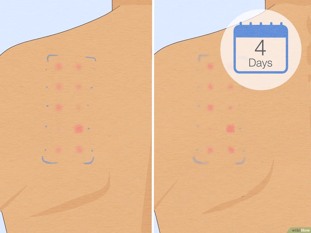 How does an allergen test work?