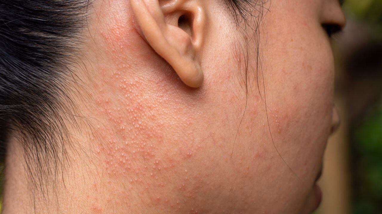 Wie gefährlich sind Duftstoffe?