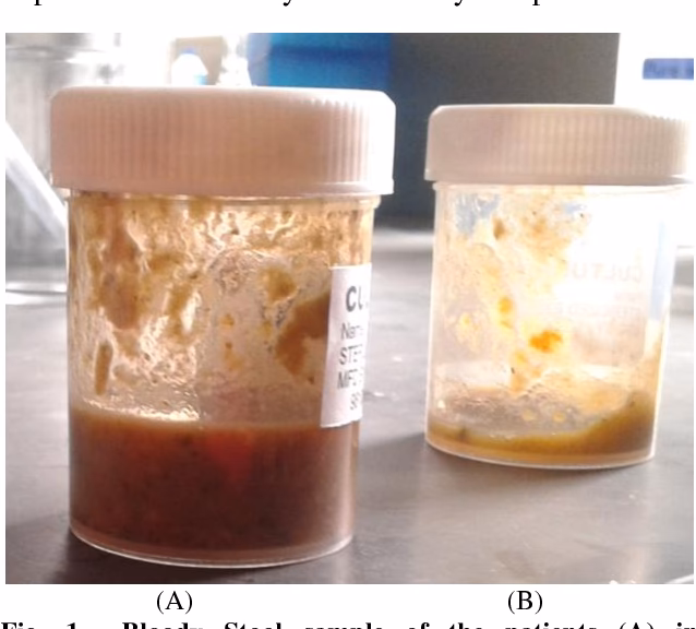What are the symptoms of E coli infection?