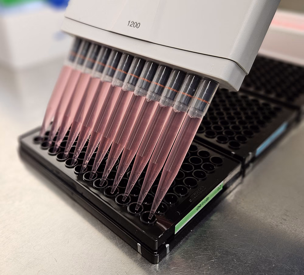 What is a rabies antibody titre – fluorescent antibody virus neutralization (favn) test?