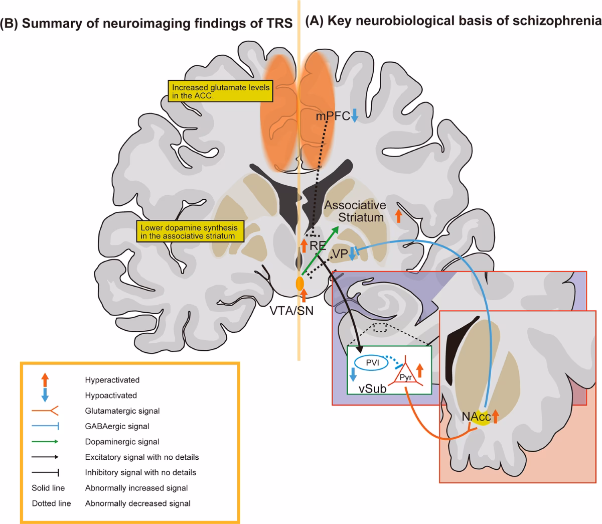 What does e-i imbalance mean in schizophrenia?