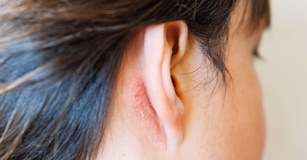 Can a sinus infection cause fluid in the ear?