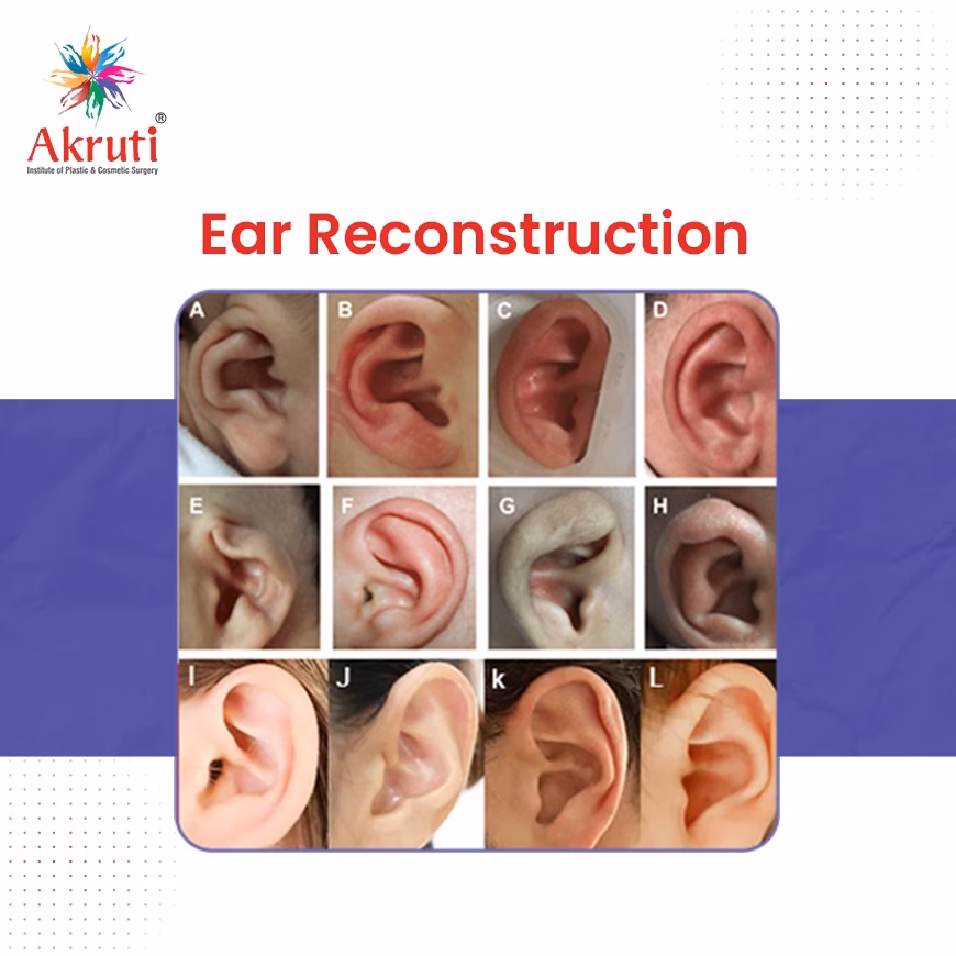 What are ear surgeries?