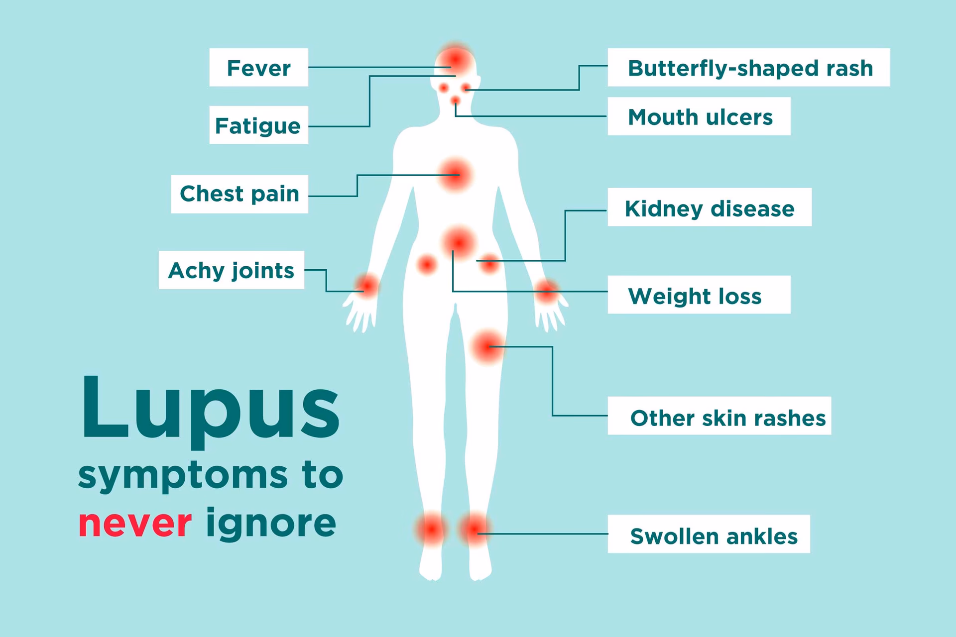 Does lupus affect women?