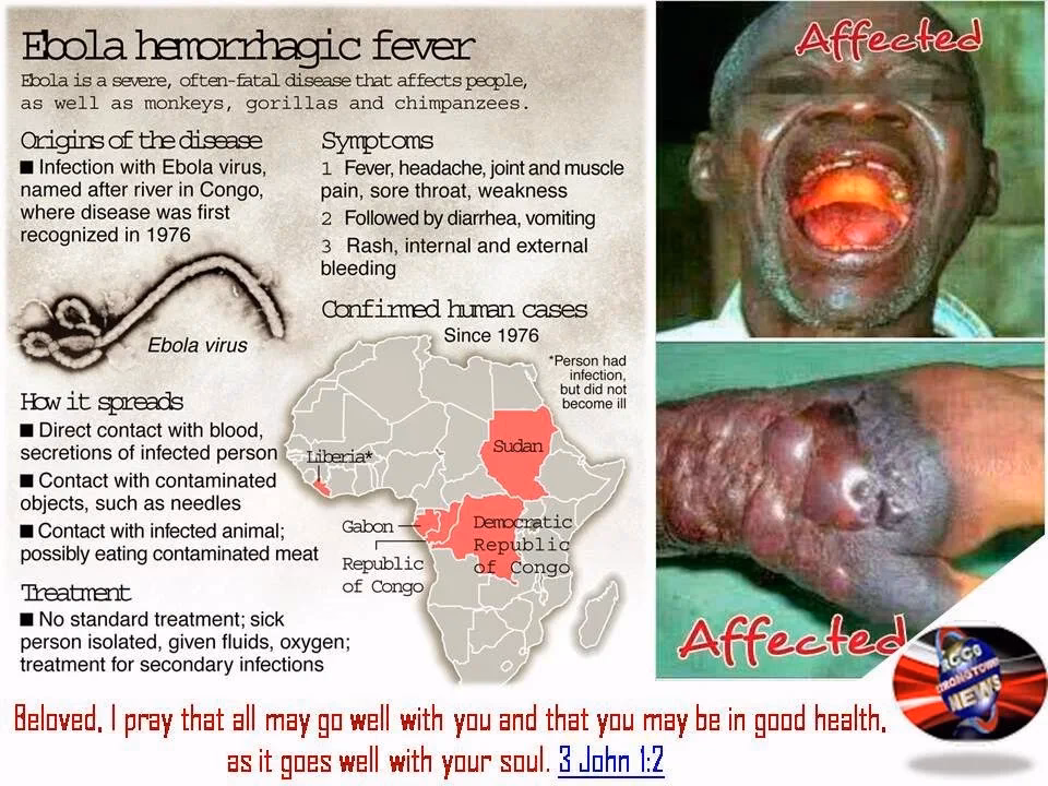 What virus causes a large Ebola outbreak?