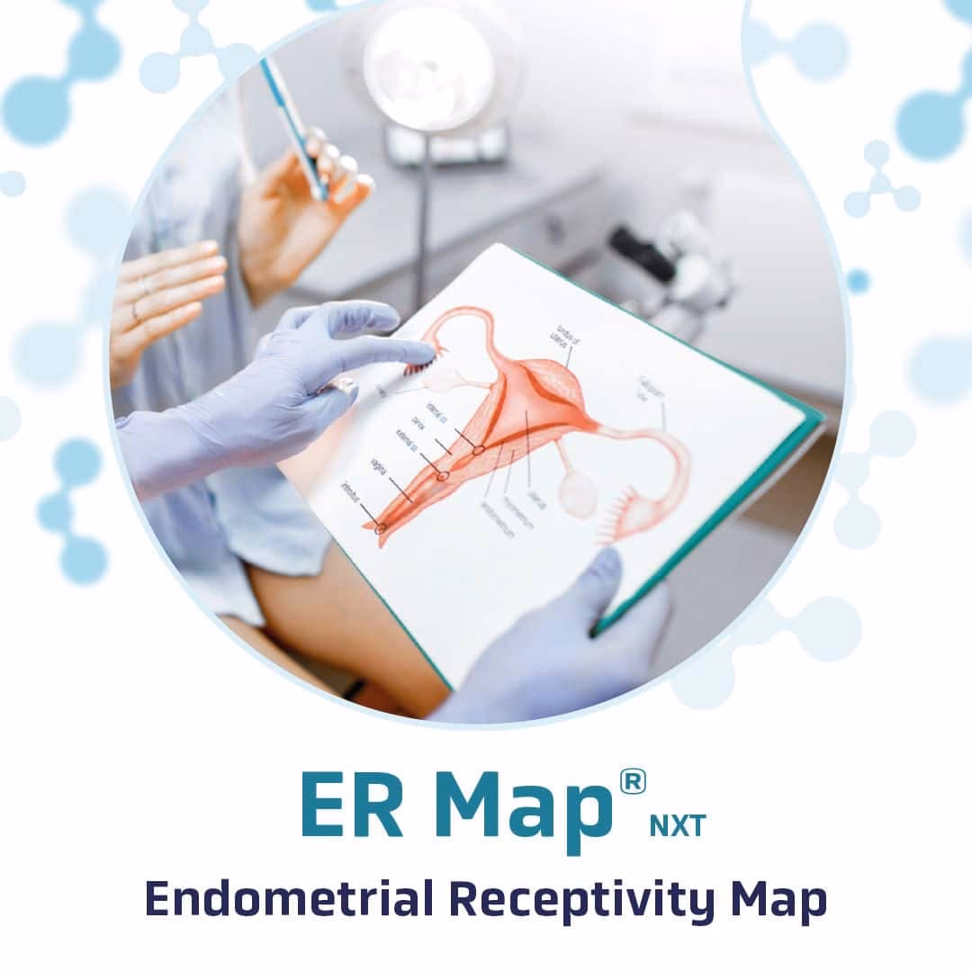 Can the new ER map®/er grade® test predict endometrial receptivity status?