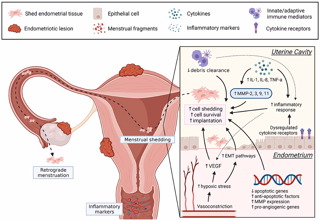 How does endometriosis affect menstrual cycle?