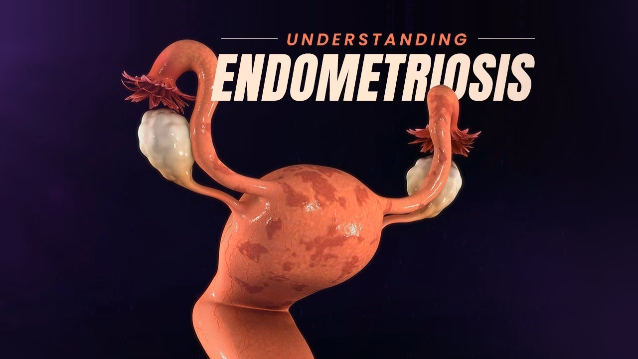 What is a 3D gynecological model?