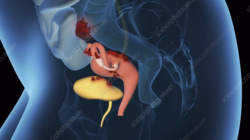 What is a 3D gynecological model?