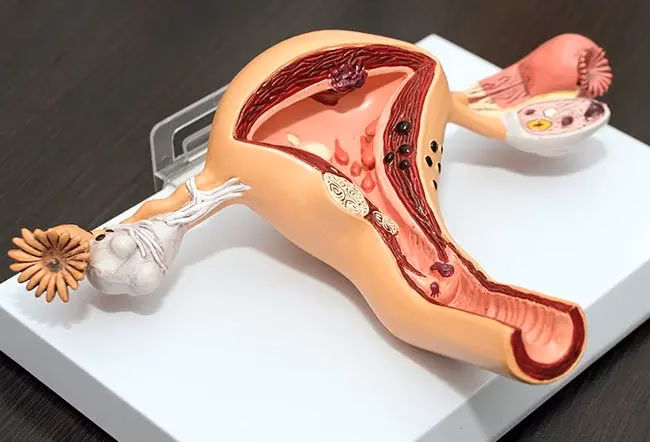 What is a normal endometrial thickness of the uterus?