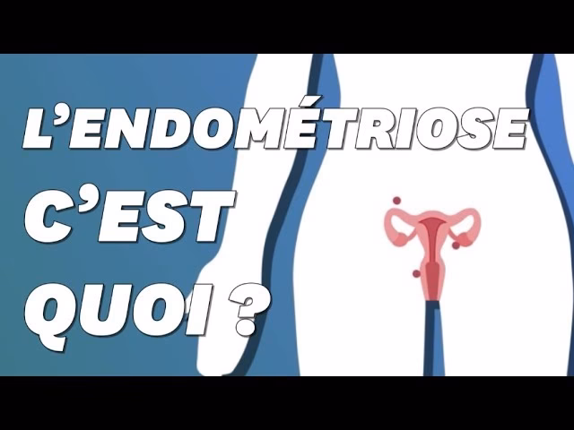 Qu'est-ce que l'endométriose?