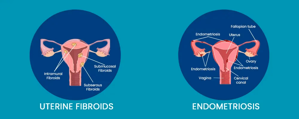 How do fibrosis and endometriosis affect embryos?