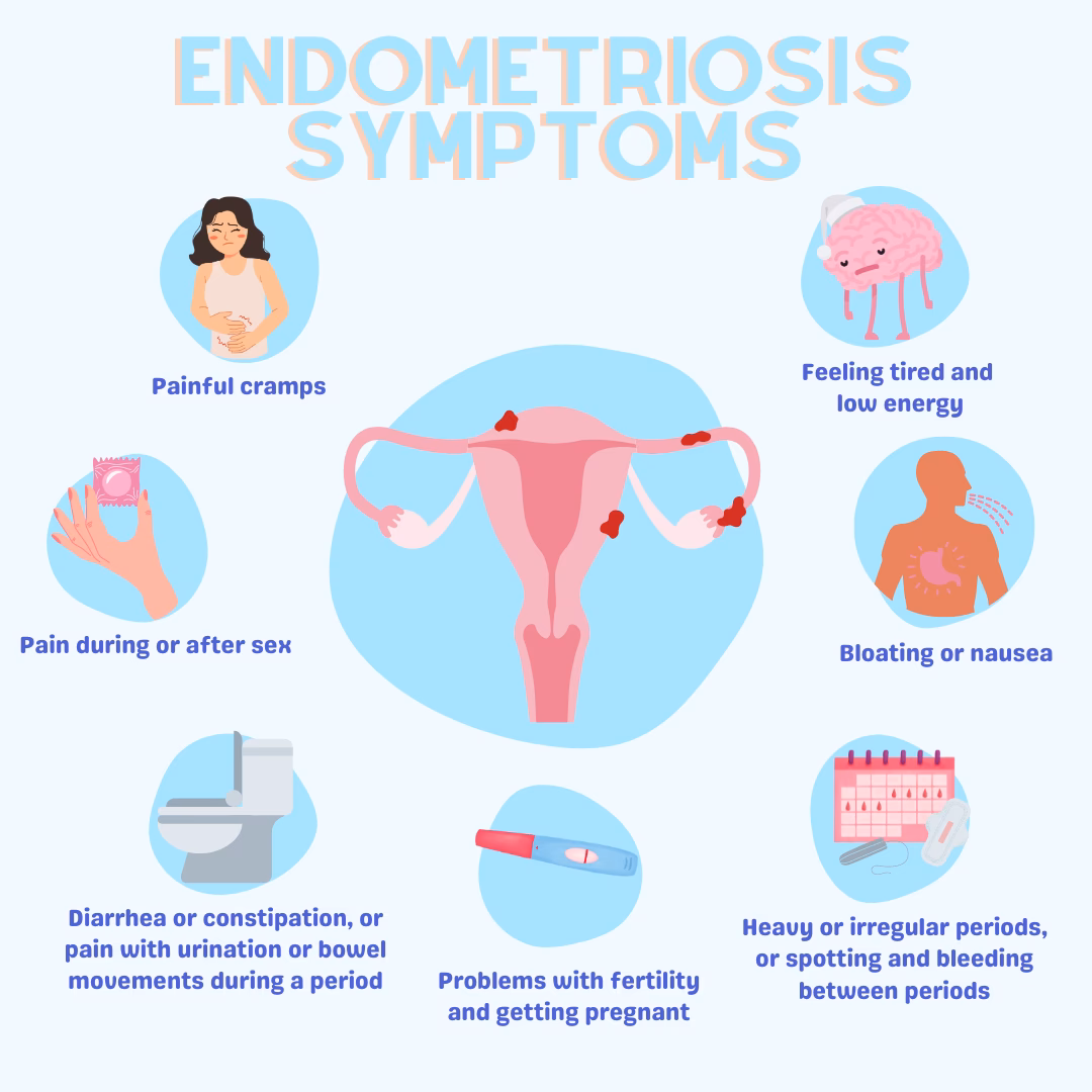What are the symptoms of endometriosis?