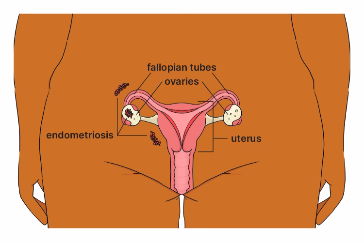 What is Jean Hailes for Women's Health?
