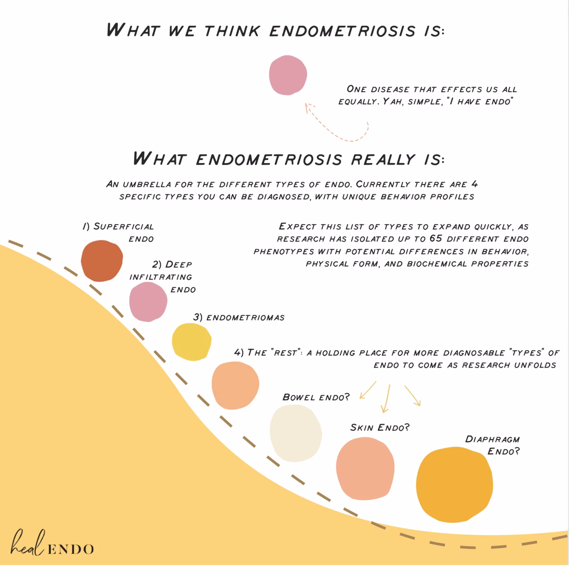 Can endometriosis cause hip joint pain?