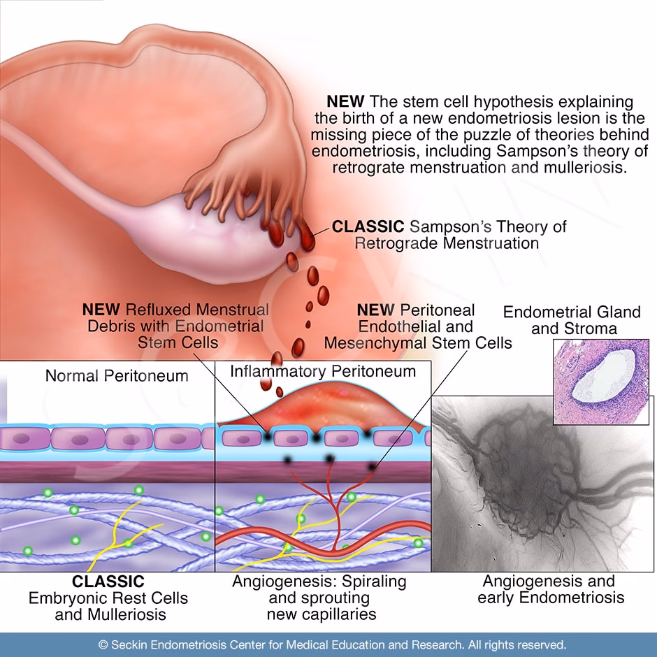 How long does a period last if you have endometriosis?