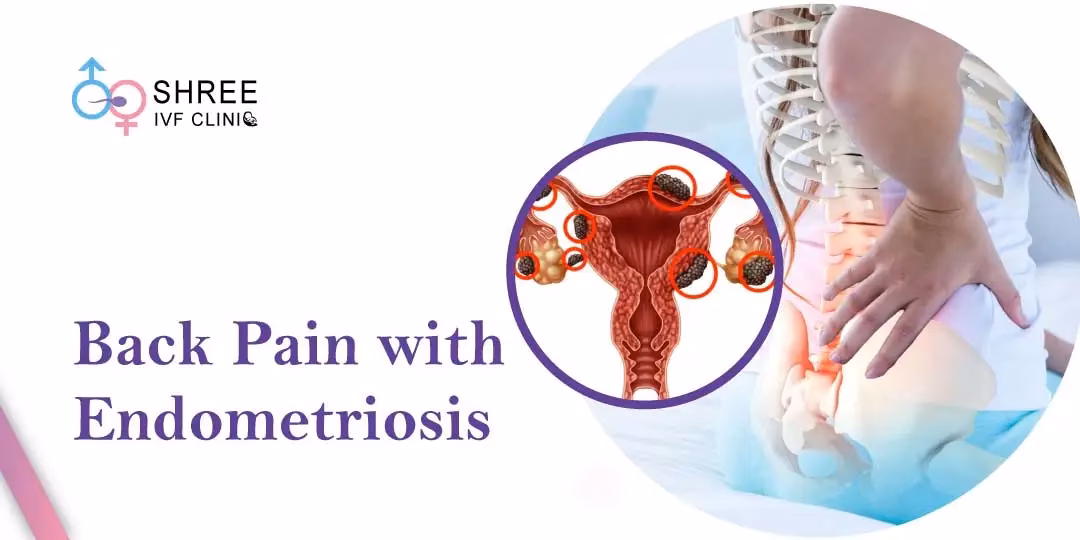 Should a woman with back pain be evaluated for endometriosis?