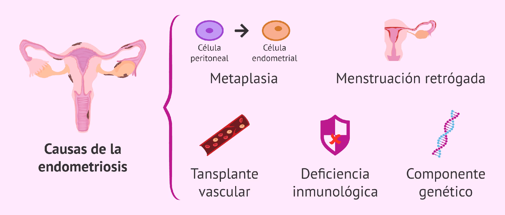 ¿Qué pasa si la endometriosis no se cura?