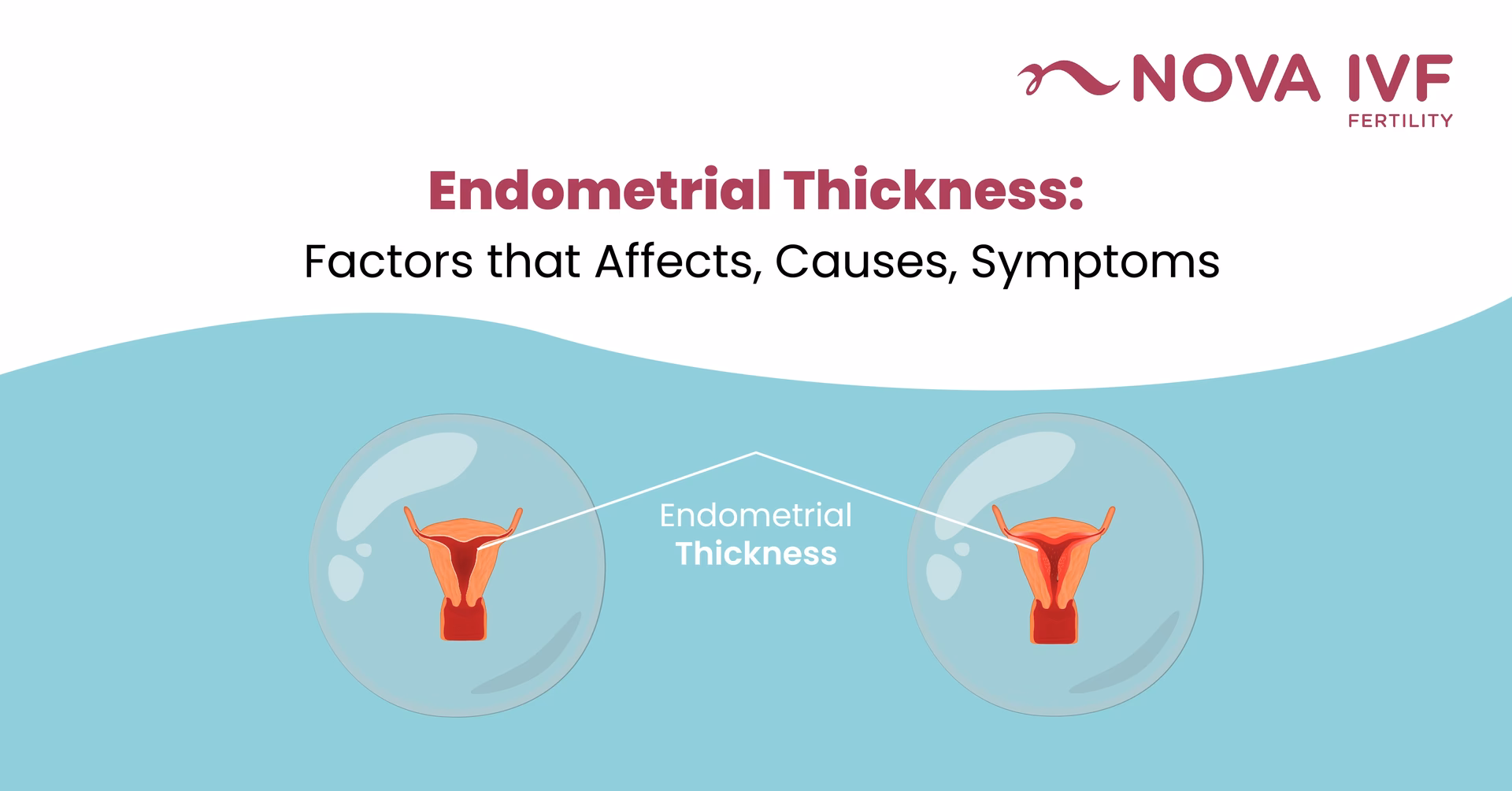 What causes a thick endometrial lining?