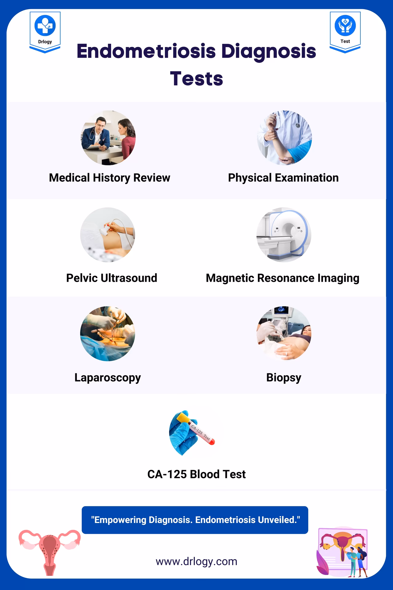 How is endometriosis diagnosed?