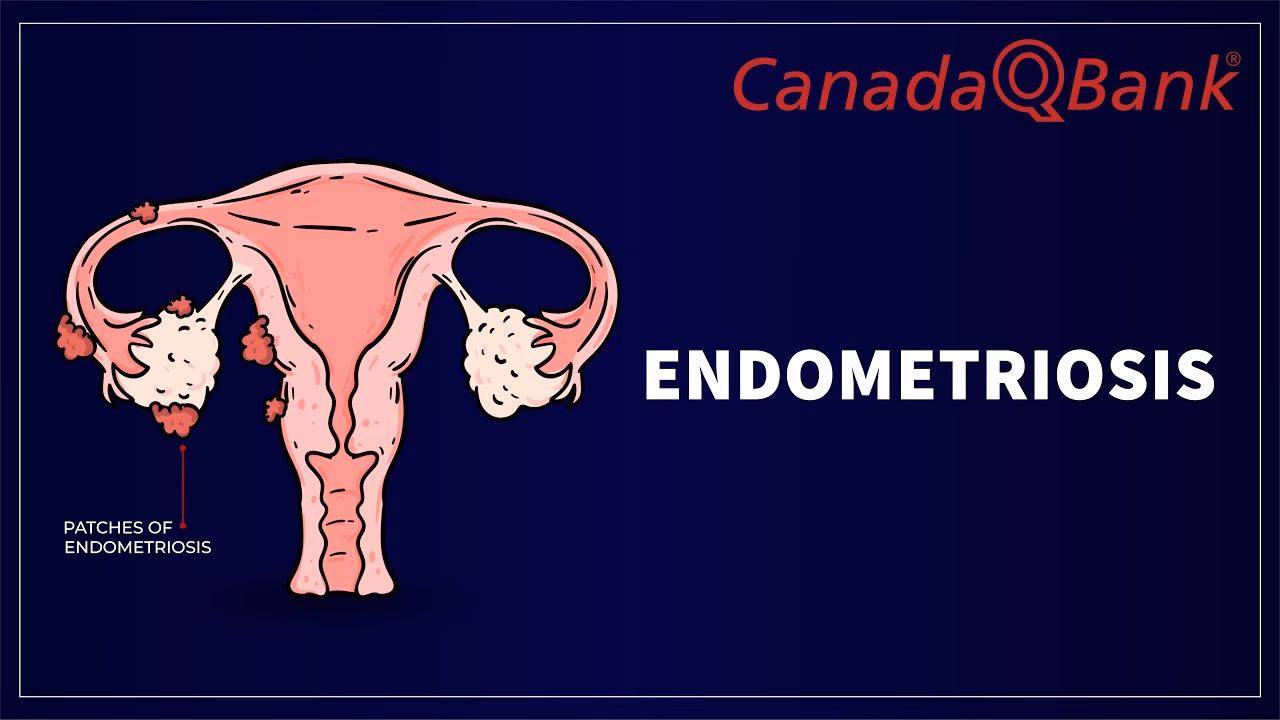 What is endometrial cancer?