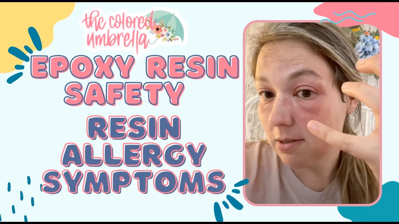 How do I prevent an epoxy resin allergy?