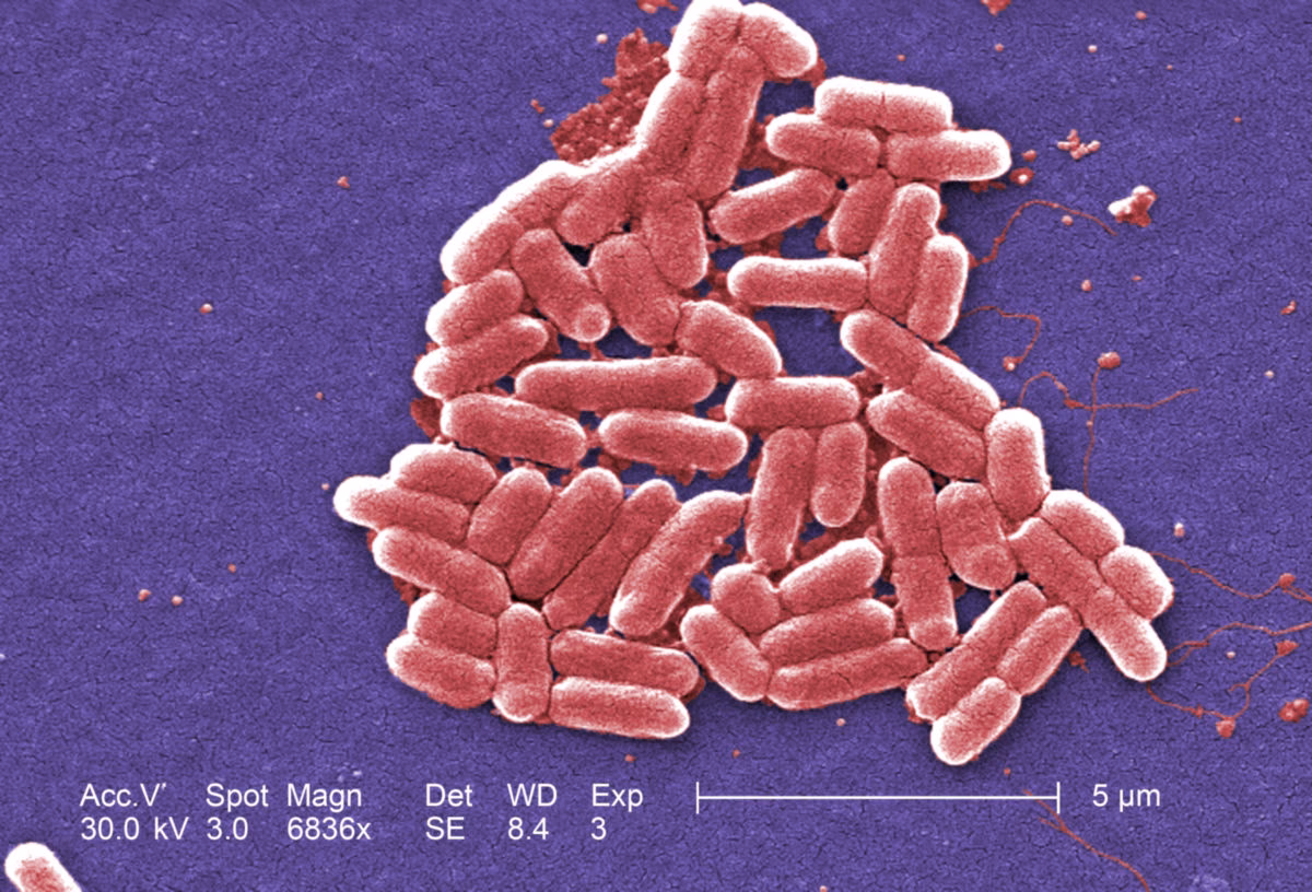 Was kann man gegen ESBL machen?